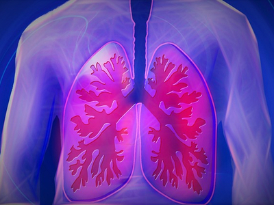 Clinical research collaboration for first line non-small cell lung cancer