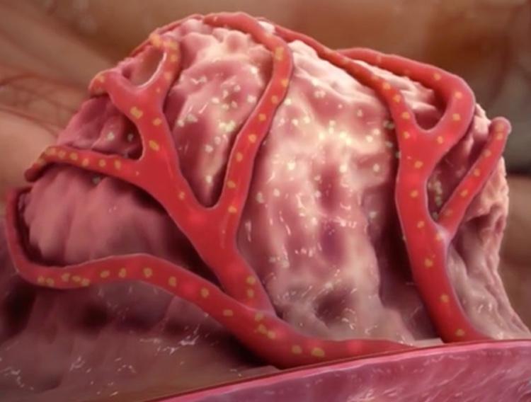 CNS Pharmaceuticals completes FDA reprocessing stipulations for API