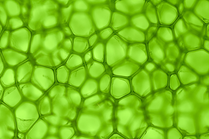 Collagen scaffold production: The freeze drying method