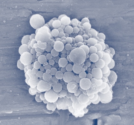Commercialising gas bubbles for cancer drug delivery