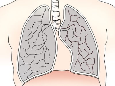 COPD market set to hit $14.1bn by 2025 says GlobalData