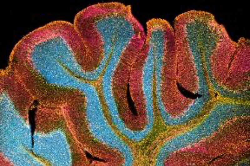 CrestOptics' spinning disk confocal system acknowledged with Microscopy Innovation award