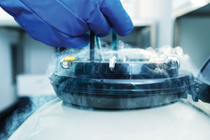 (Cryo)preserving your research