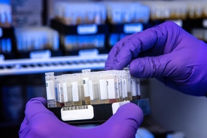 Danaher set to acquire antibody company Abcam