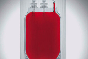 Double protection bag improves storage of stem cell samples
