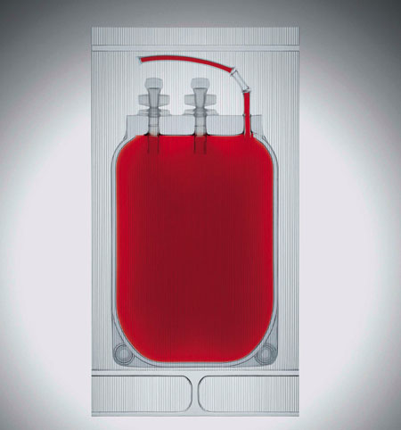 Double protection bag improves storage of stem cell samples