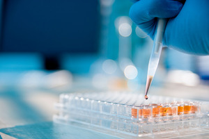 dsm-firmenich launches Biond pharmaceutical-grade vitamin portfolio for cell culture and biologics manufacturing