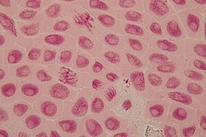 Dual inhibition of motor proteins KIF18A and CENP-E shown to selectively kill cancer cells