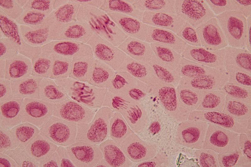Dual inhibition of motor proteins KIF18A and CENP-E shown to selectively kill cancer cells
