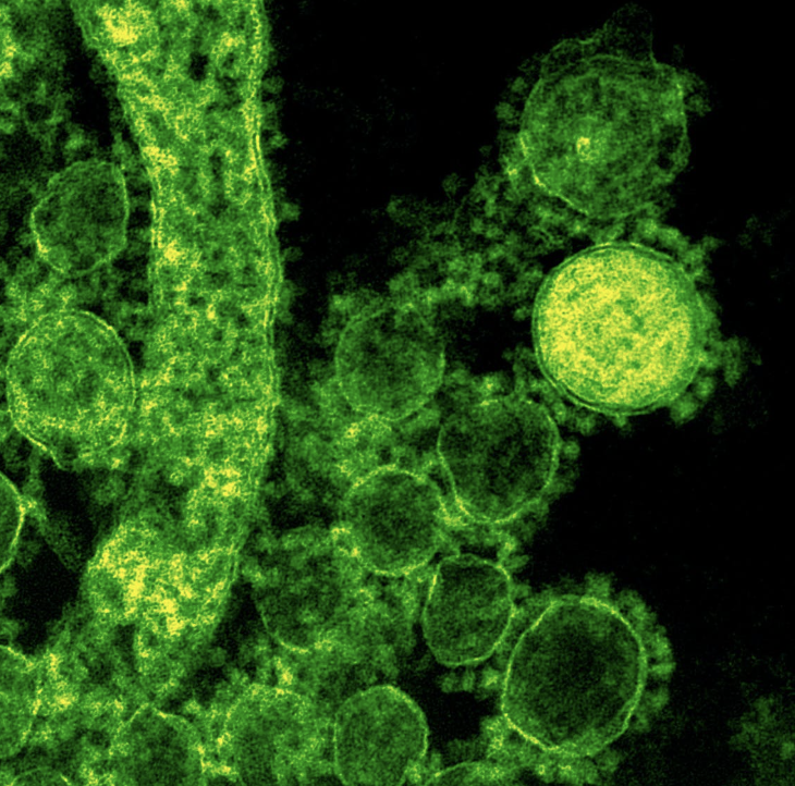 e-FabRIC consortium awarded €7.7m to develop broad-spectrum therapy against viruses with pandemic potential