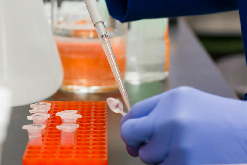 Eli Lilly and Alchemab Therapeutics team up to discover and develop ALS antibodies