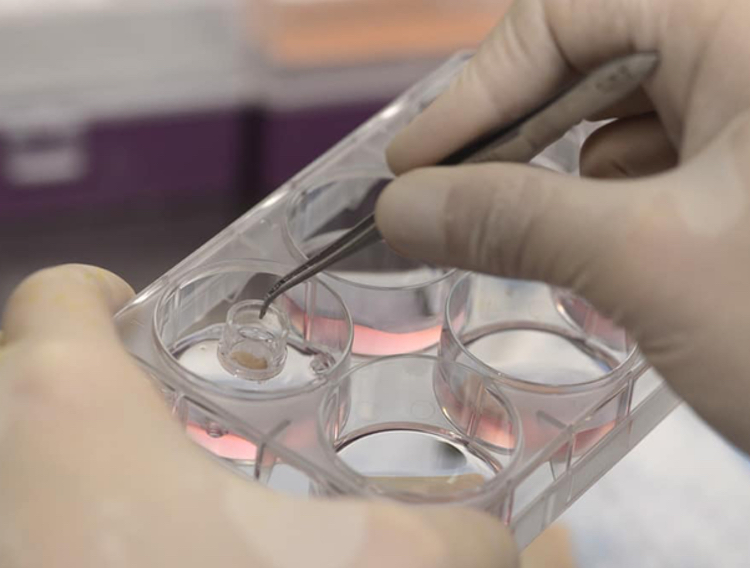 Eli Lilly makes $1.1bn biopharma acquisition