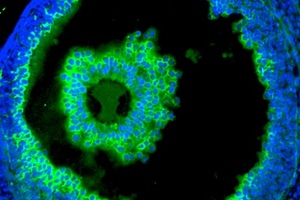 ELISA-like Assay for Hyaluronic Acid