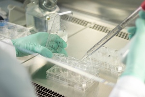 Evox expands exosome platform for drug delivery