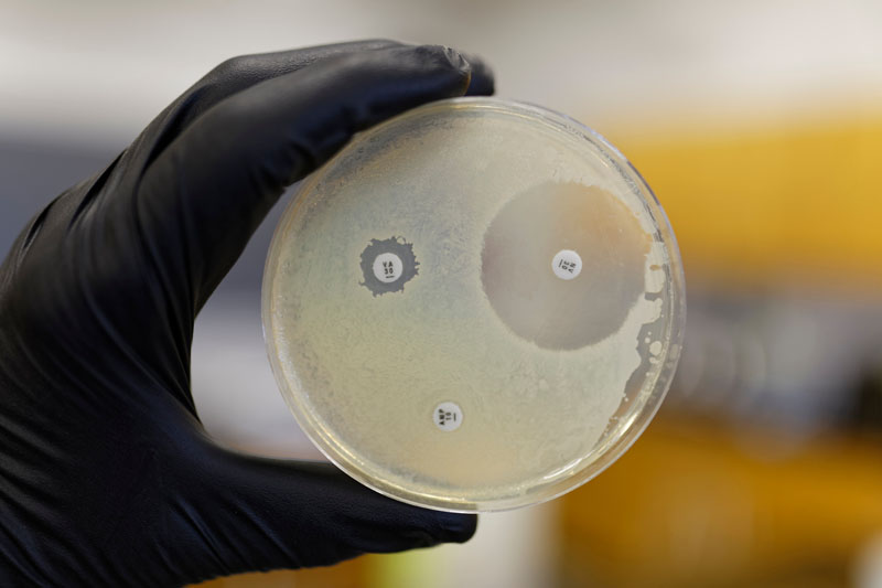 Experts uncover how bacteria modify themselves to outsmart antibiotics