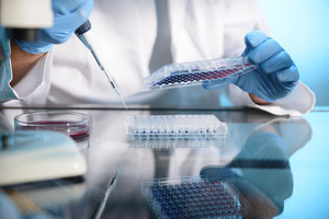 Exscientia initiates sixth AI drug discovery partnership