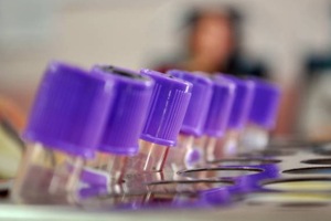FDA approval filed for plasma manufacturing facility
