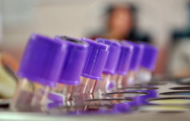 FDA approval filed for plasma manufacturing facility