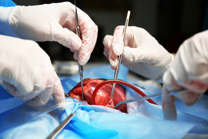 FDA grants Orphan Drug Designation to pegrizeprument for prevention of heart transplant rejection