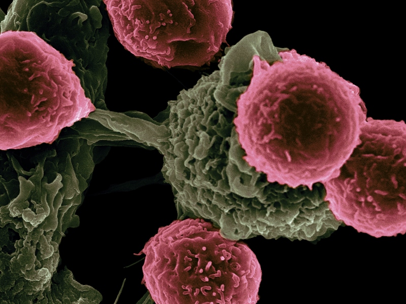 FluoGuide completes patient enrolment for trial of patients with head and neck cancer