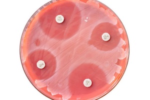 Forge and Basilea partner on antibiotic discovery