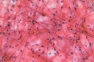 Galapagos expands fibrosis portfolio