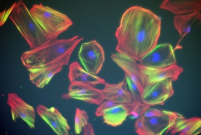 The winner of the Asia/Rest of the World region was Lesley Caron who took this image during her research into inheritable muscle disease