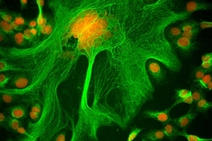 GE Healthcare names IN Cell Analyser image competition winners