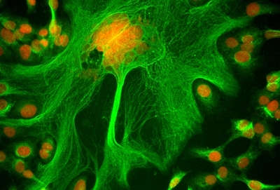 GE Healthcare names IN Cell Analyser image competition winners