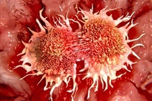 Glythera and Cancer Research UK announce licence agreement