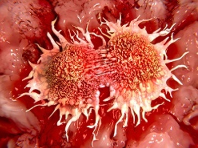 Glythera and Cancer Research UK announce licence agreement