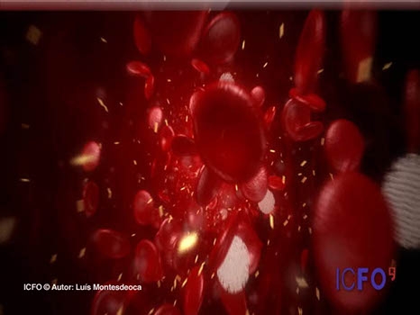 Gold nano particles could be used to treat cancer
