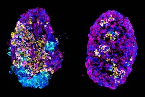 Harvard and Semma Therapeutics improve insulin yield from stem cells
