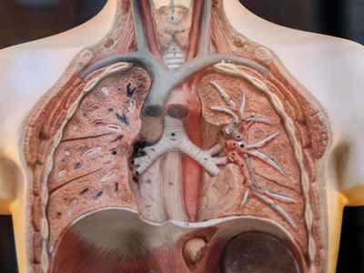 Hope for cystic fibrosis with range of novel treatments in development