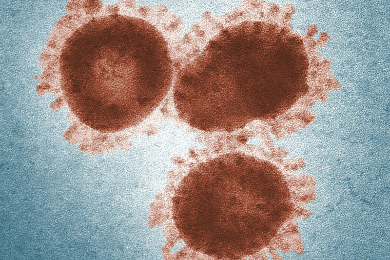 Hornet Therapeutics publishes data on potential drug intervention strategy for EBV-driven disease