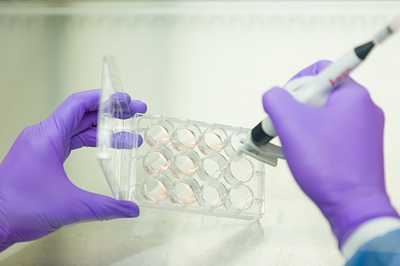 How iPSCs can bridge the translational gap in neuroscience