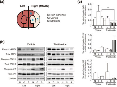 How thalidomide is effective against cerebral infarction