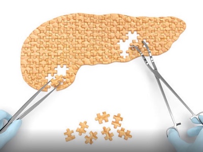 Improvements needed for clinical trial design in pancreatic cancer