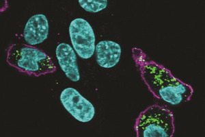 Improving delivery with macrophage targeting