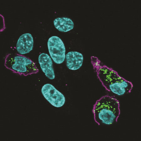 Improving delivery with macrophage targeting