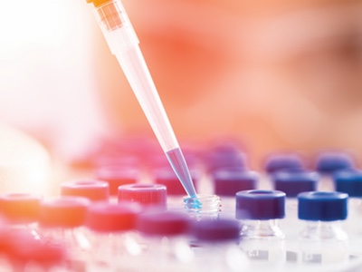 In vitro release testing method developed for validation of semisolids