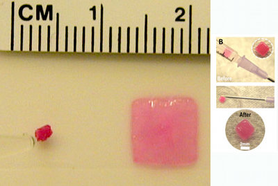 Injectable sponge delivers drugs, cells, and structure