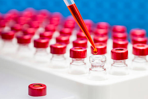 IONTAS signs collaboration agreement with LG Chem