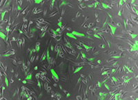 Johns Hopkins develops gene therapy technique for cancer