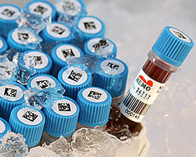 Labels for ultra-low temperature use