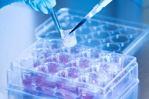 LabSkin and Aston University partner to develop lab-grown skin for wound research