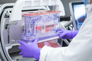 Leucid Bio chooses Lonza automated personalised CAR T-Cells platform