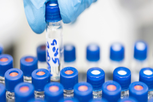 LGC releases clinical diagnostic kit for COVID-19 variant analysis