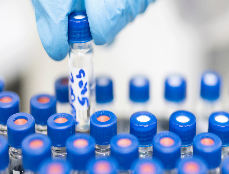 LGC releases clinical diagnostic kit for COVID-19 variant analysis