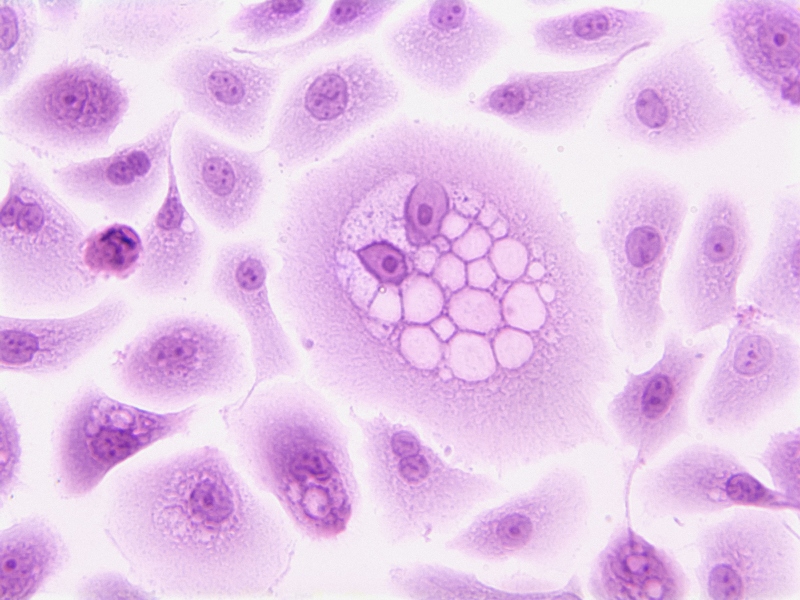 Luxembourg scientists develop compound that inhibits oncogene translation